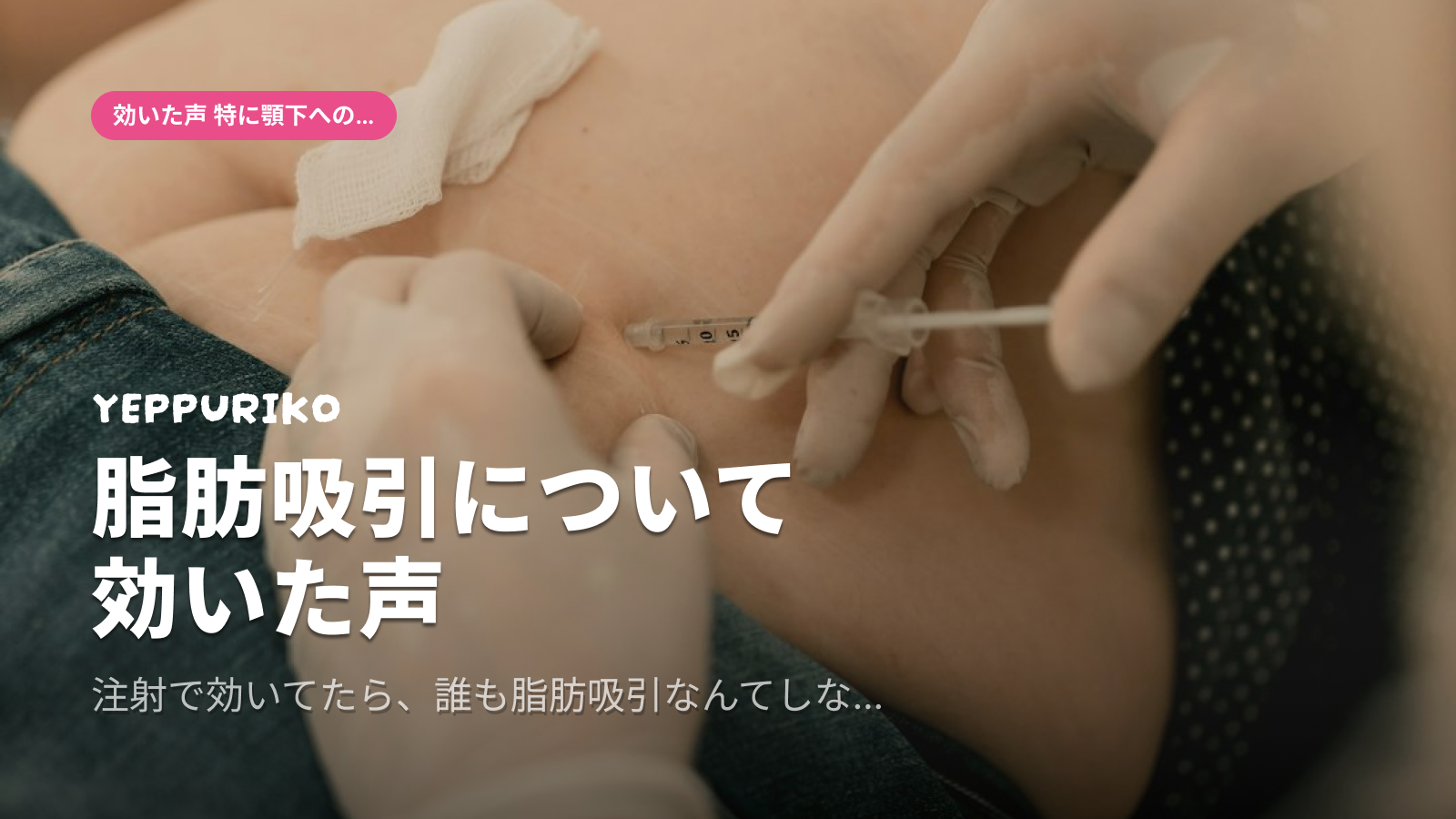 🎯 そもそも「効くの？効かないの？」問題