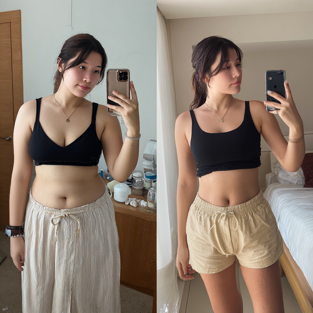 韓国で大人気のウゴービとマンジャロ、どっちを選ぶ？