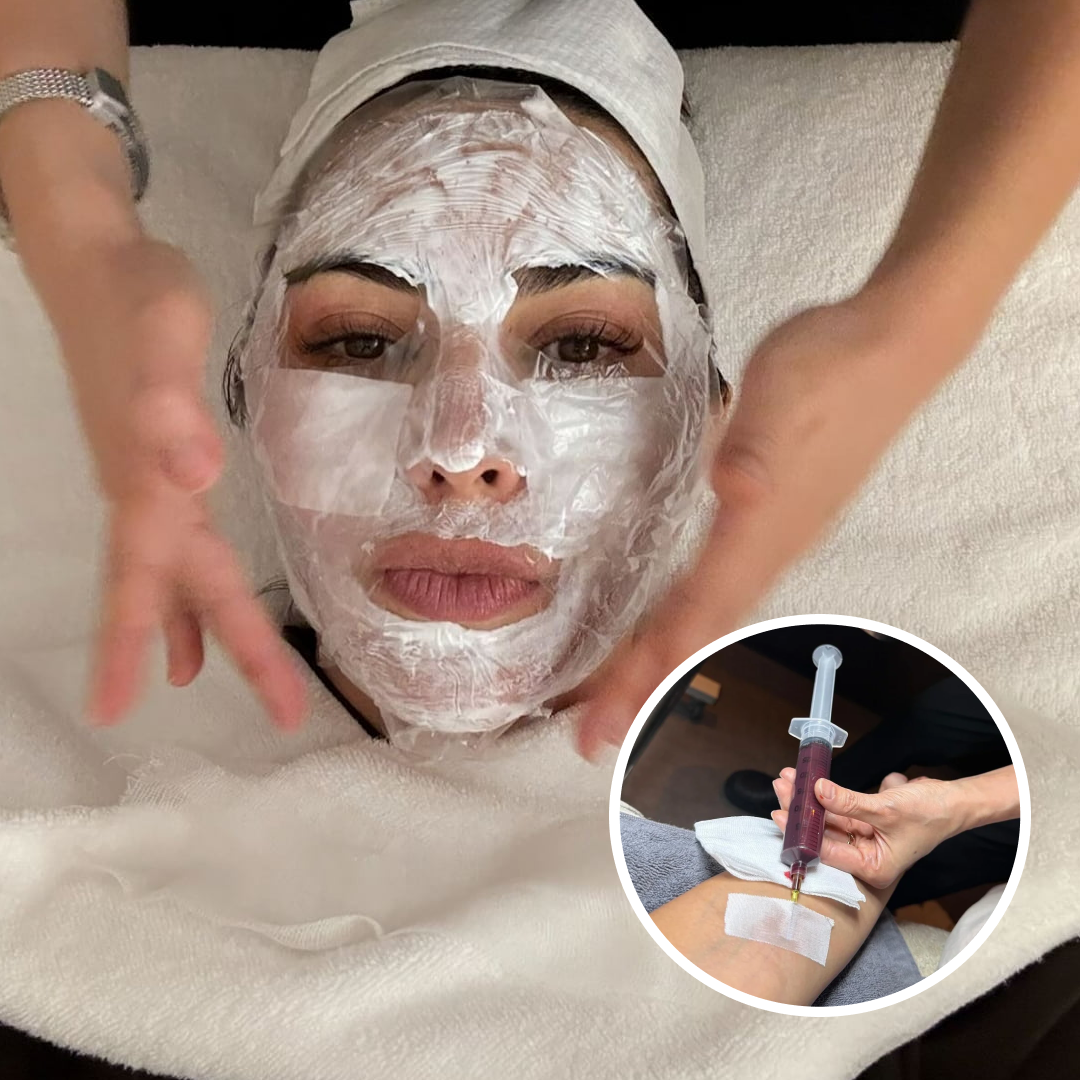 キム・カーダシアン韓国で幹細胞治療