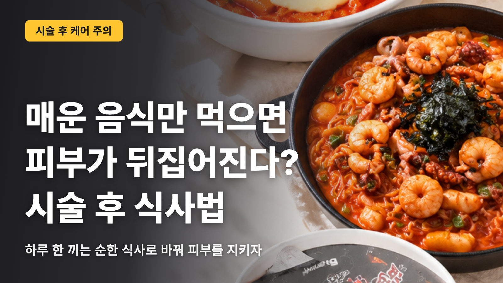 한국에 있는 동안 매운 음식만 먹으면 피부에 나타날까? 시술 후 식사 가이드