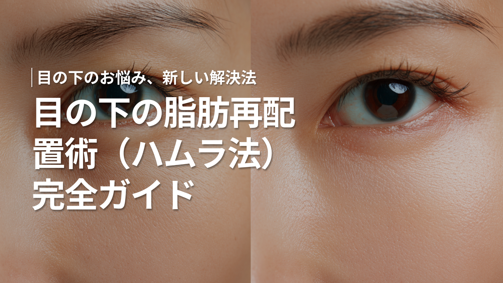 目の下の脂肪再配置術（ハムラ法）完全ガイド