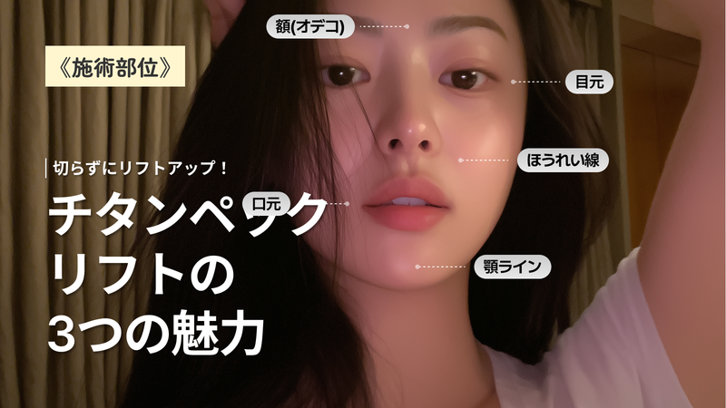 チタンペックで自然なリフトアップ|韓国の最新施術を徹底解説