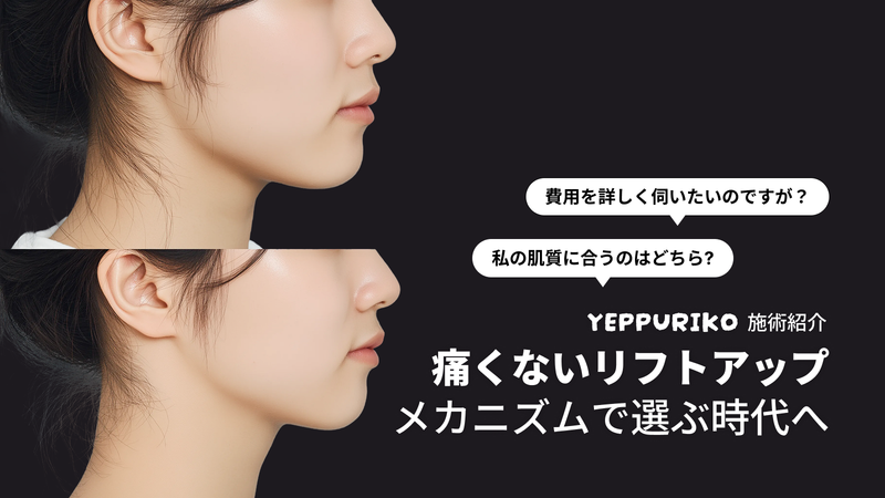 チタニウムvsオンダリフト|違いと選び方|痛くないリフト