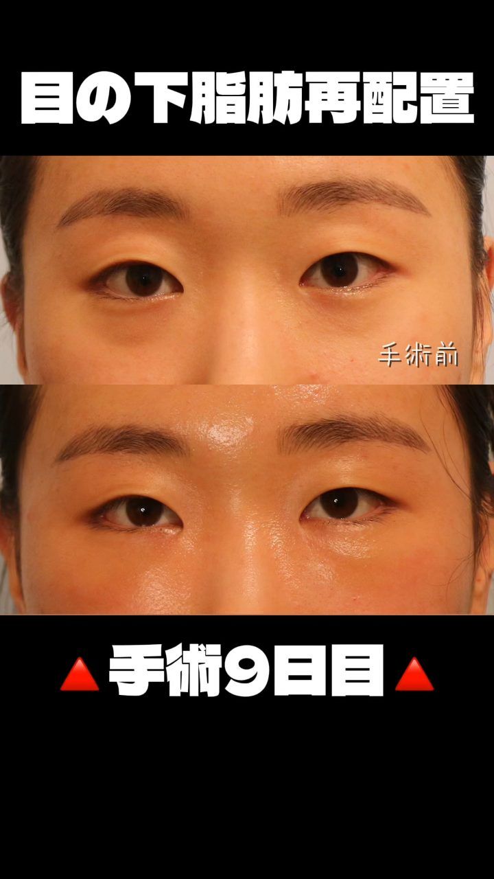 ST성형외과