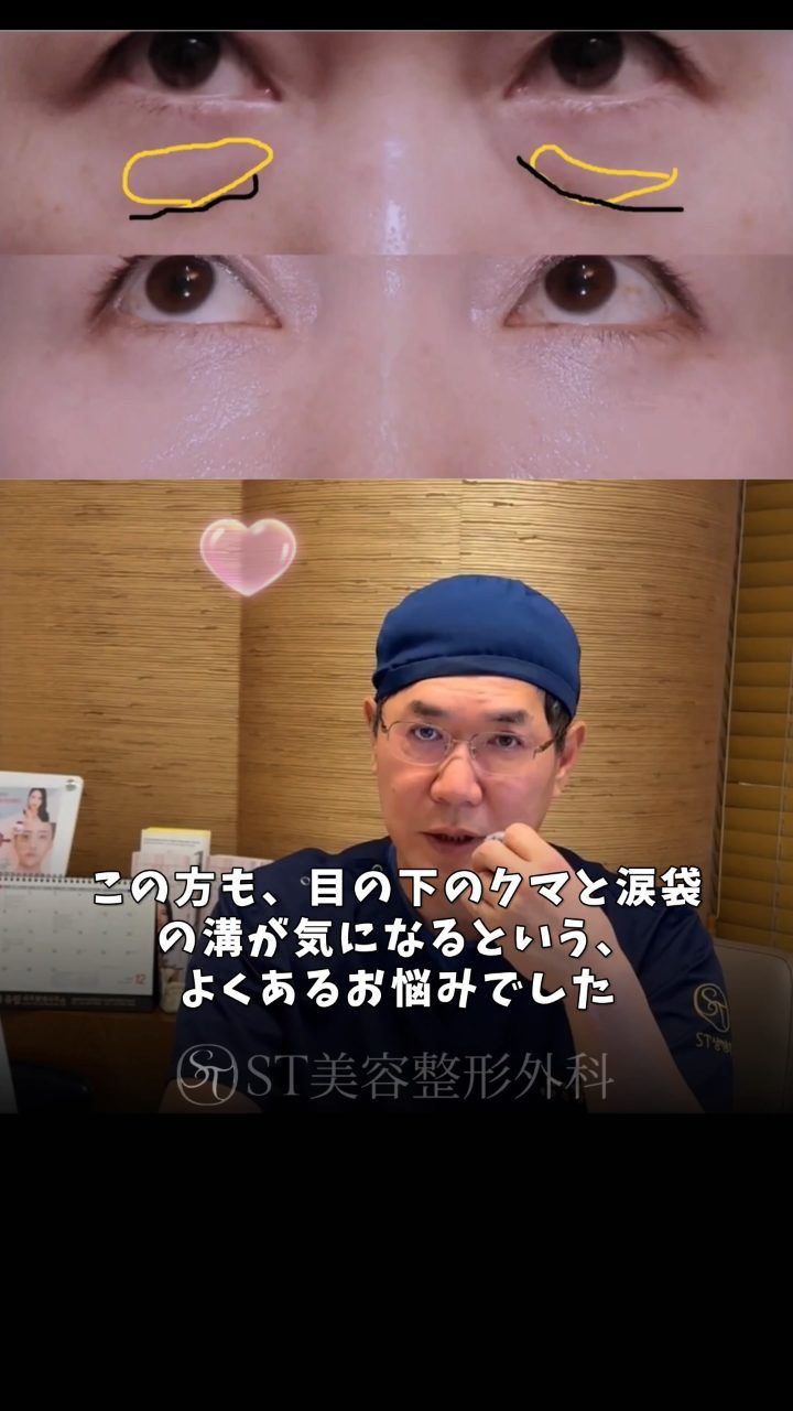ST성형외과