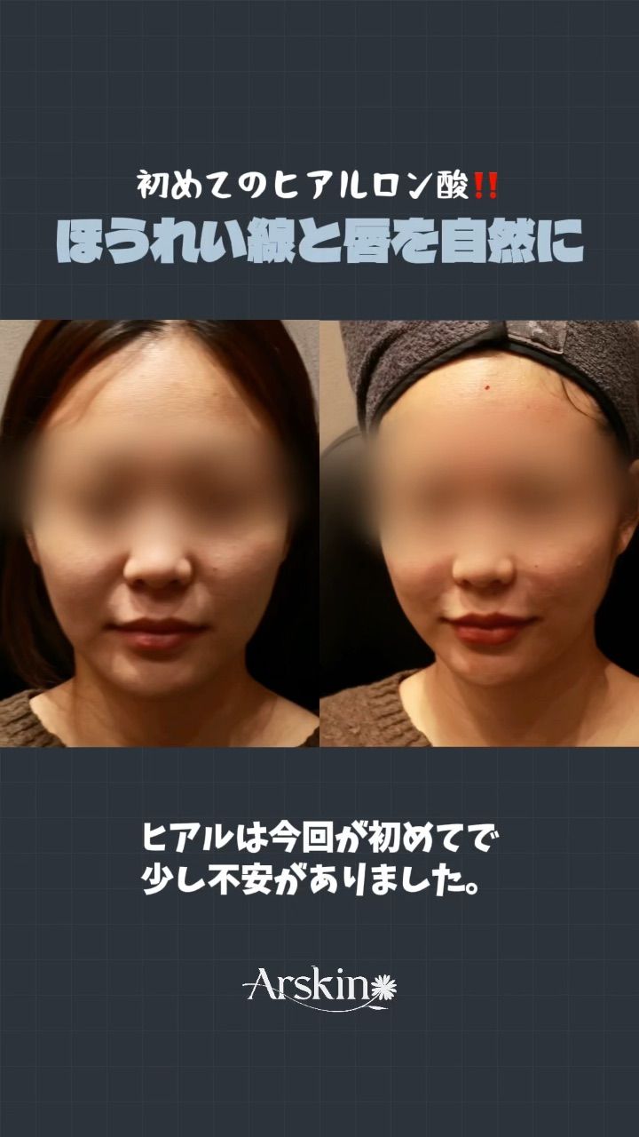 アルスキンクリニックホンデ院