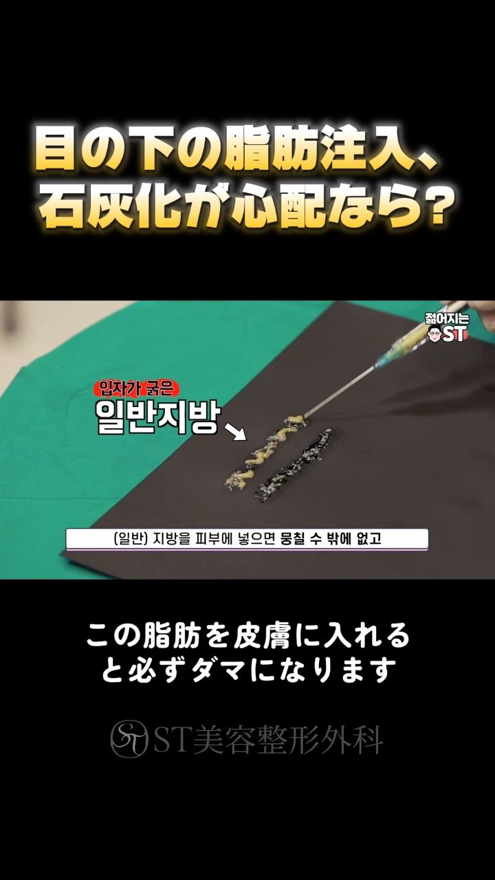 ST성형외과
