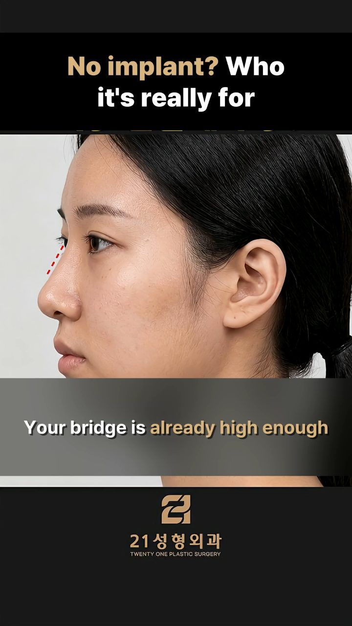 21 Plastic Surgery